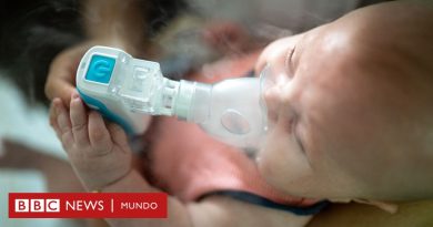 "Tripledemia", el ataque múltiple de virus respiratorios que satura los hospitales de niños en EE.UU. y algunos países de Sudamérica - BBC News Mundo