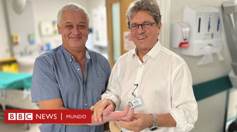 El singular reencuentro entre paciente y cirujano 10 años después del primer trasplante de mano en Reino Unido - BBC News Mundo