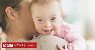 La drástica caída de nacimientos de bebés con síndrome de Down en Europa (y el debate que genera) - BBC News Mundo