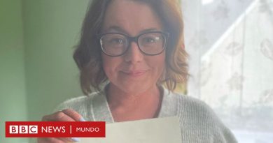 "Me preguntaban si tenía quemaduras": la rara enfermedad que hace crecer la piel demasiado rápido - BBC News Mundo