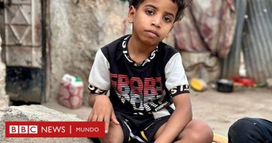 Guerra en Yemen | "Si el sufrimiento tuviera una dirección sería la calle al-Rasheed en Yemen": los niños de un conflicto olvidado  - BBC News Mundo