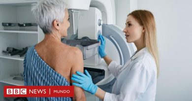 Cáncer de mama: la píldora que ofrecerán a miles de mujeres en Reino Unido para prevenir esta enfermedad - BBC News Mundo