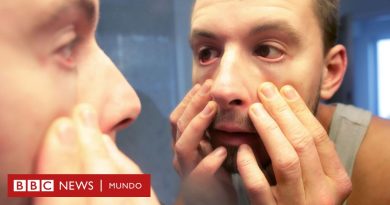 Hipocondría: por qué las personas que sufren trastorno de ansiedad por enfermedad mueren antes que aquellos que se preocupan menos por su salud - BBC News Mundo