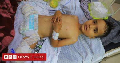 Israel - Hamás | Heridos y solos: los niños de Gaza que han quedado huérfanos - BBC News Mundo